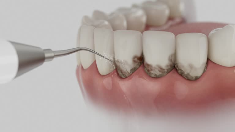 Reliable Emergency Dentist contractor in Itasca, IL by Smile Center Dentistry